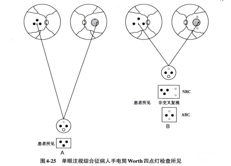 正真视光学院·四孔灯教学方法