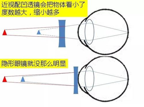 双眼度数不一样应该怎么配镜，德州验光师培训学校-正真视光